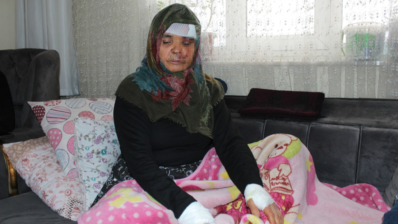 Kızının köpeği Fadimana'yı bu hale getirdi