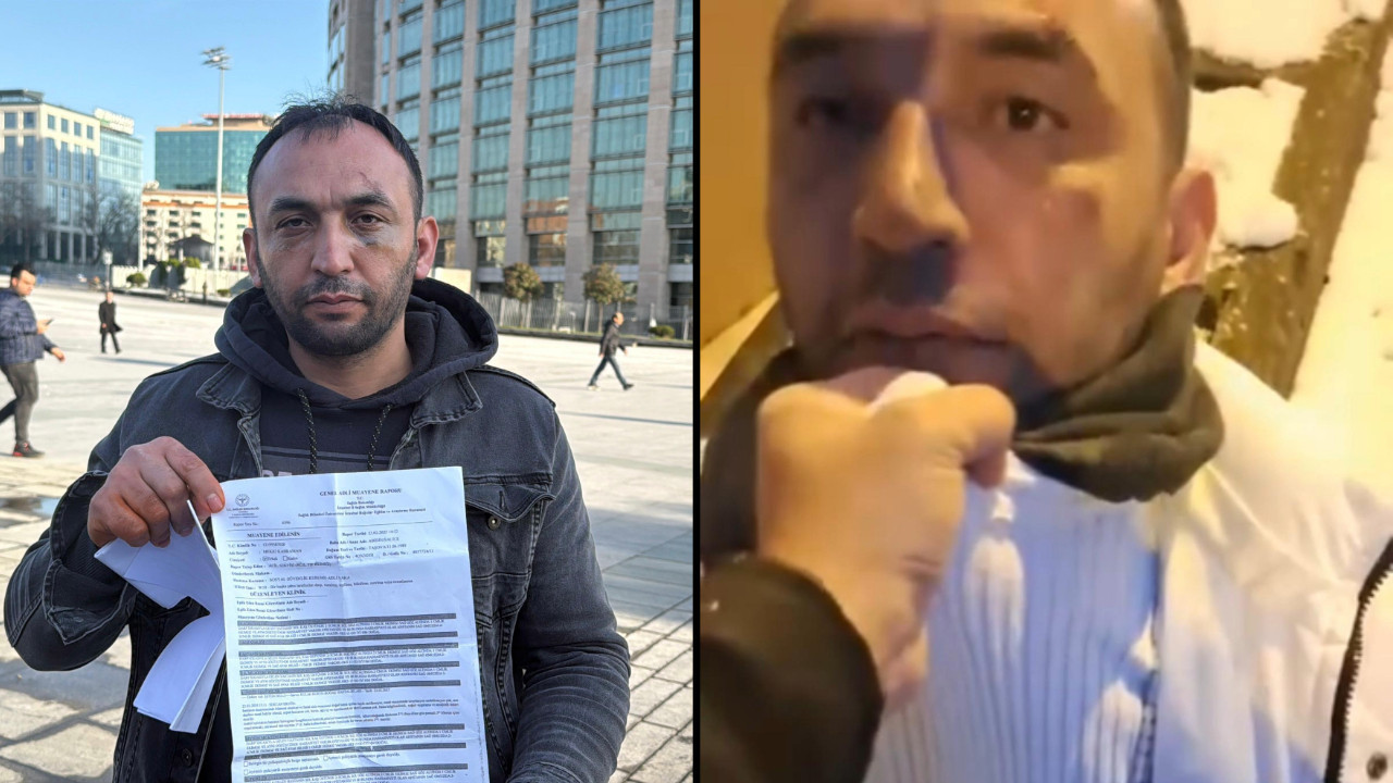 Eski sevgiliye, yeni sevgili dayağı: Dövdü, bayılttı, kimliğini aldı