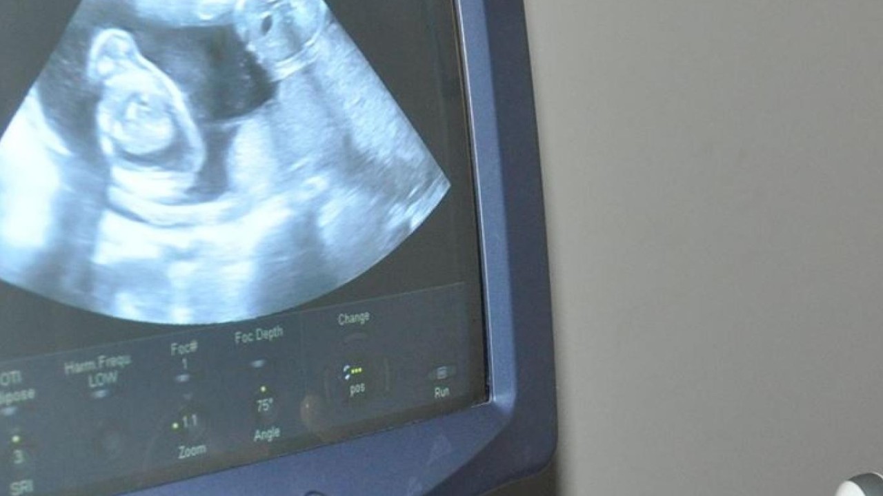 Böyle dolandırıcılık görülmedi: 'Bebek anne karnında öldü' deyip sahte kürtajlar yapmış
