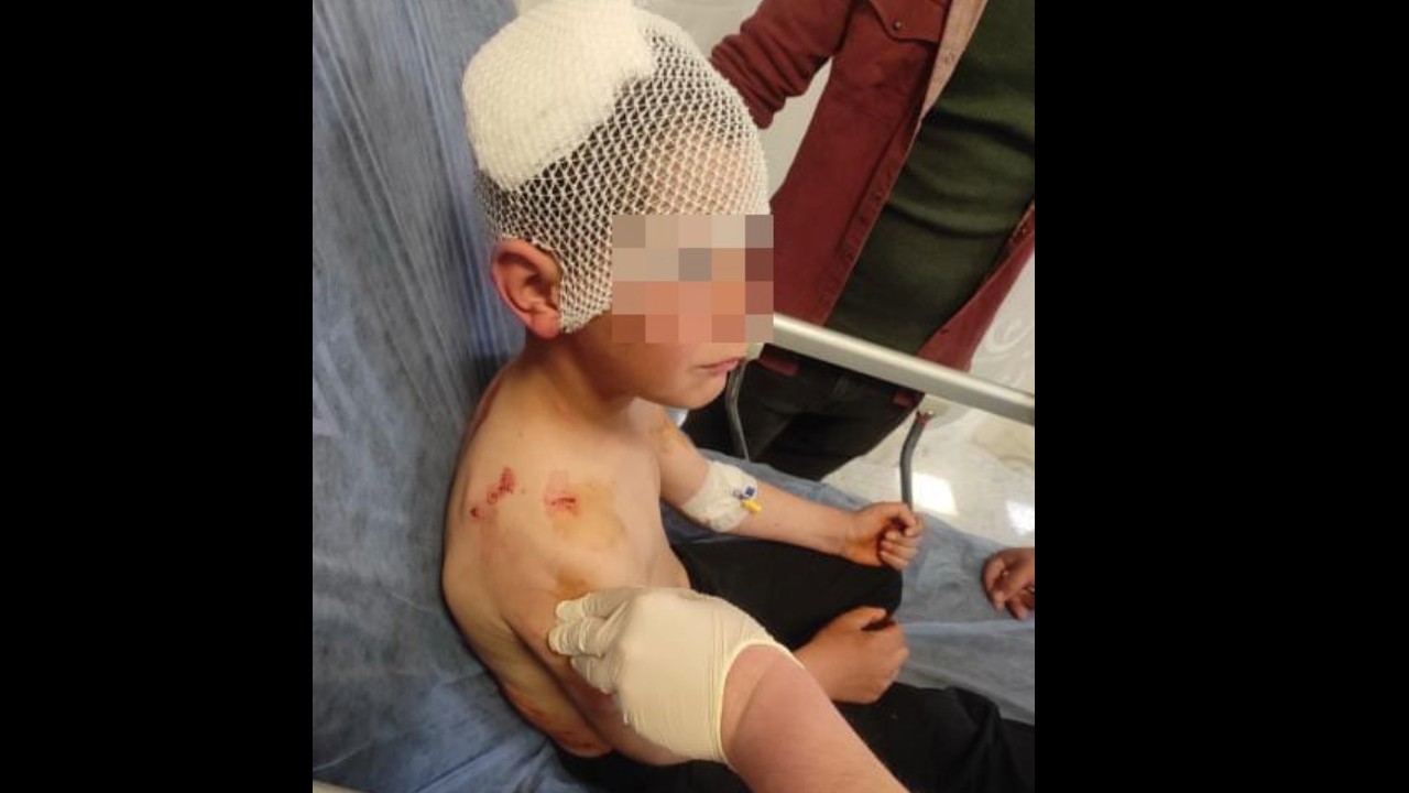 Isparta’da sokakta oynayan çocuğa başıboş köpek saldırdı