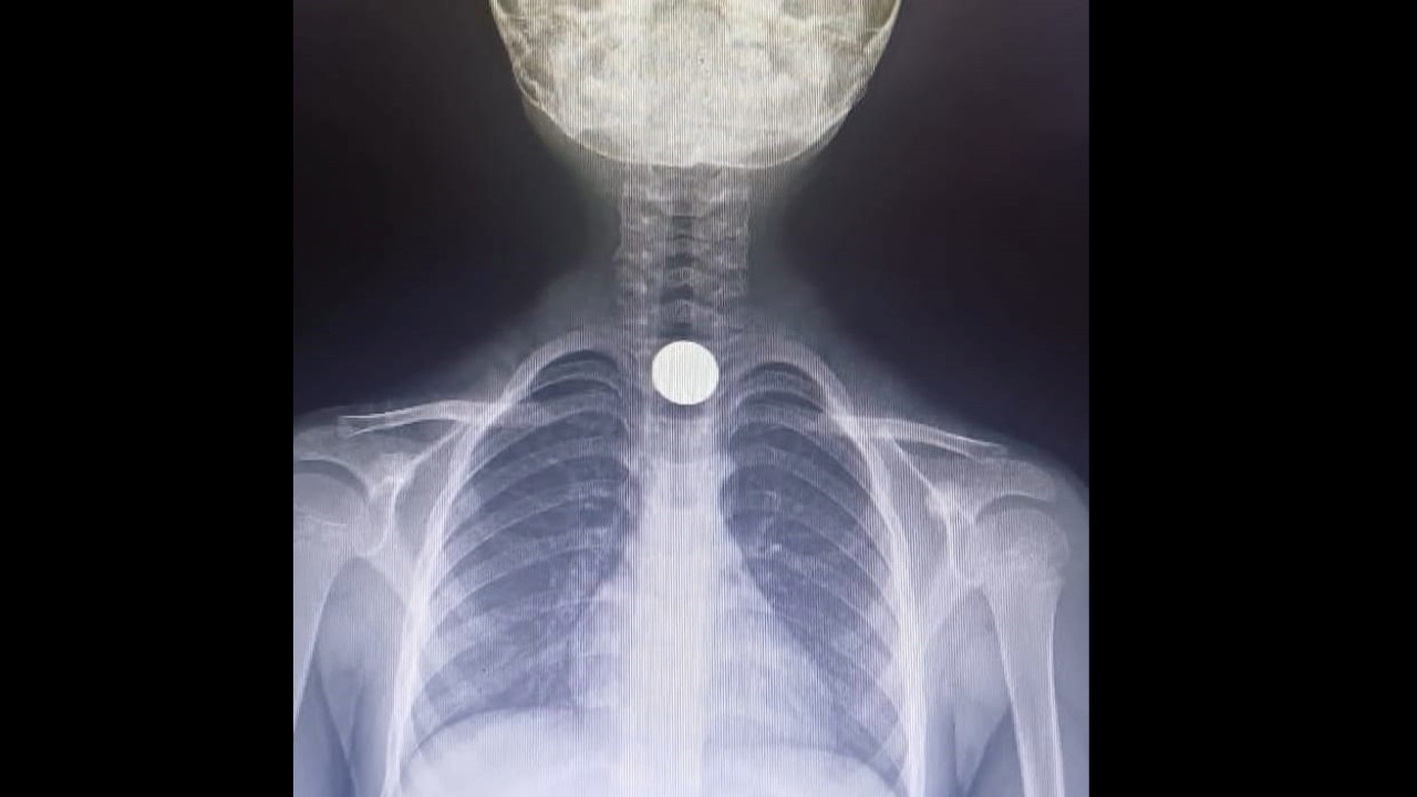 Operasyonla çıkarıldı