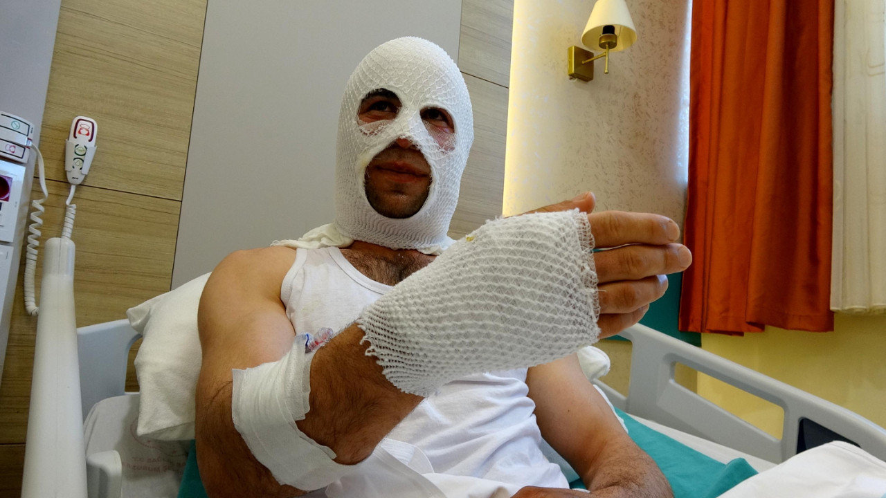 Nişanlısına hediye paketi hazırlarken hastanelik oldu