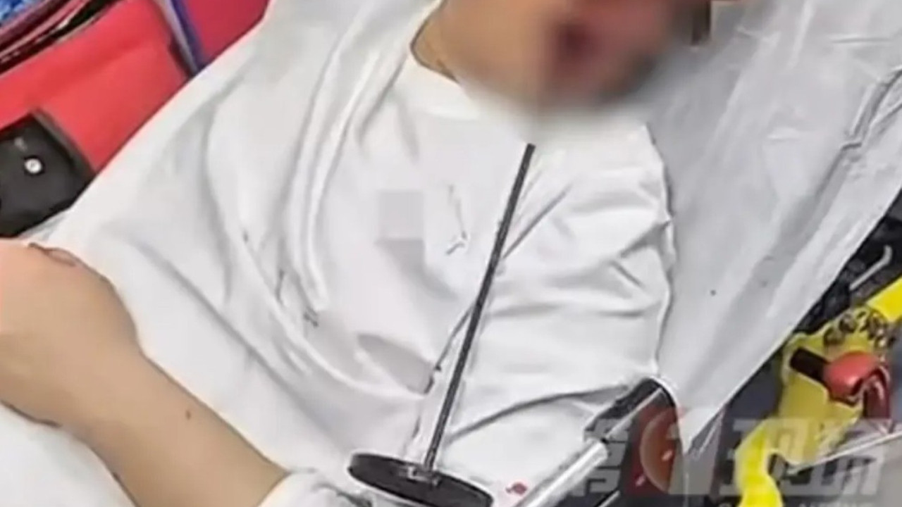 Korkunç olay: Restoranda dengesi bozulunca...