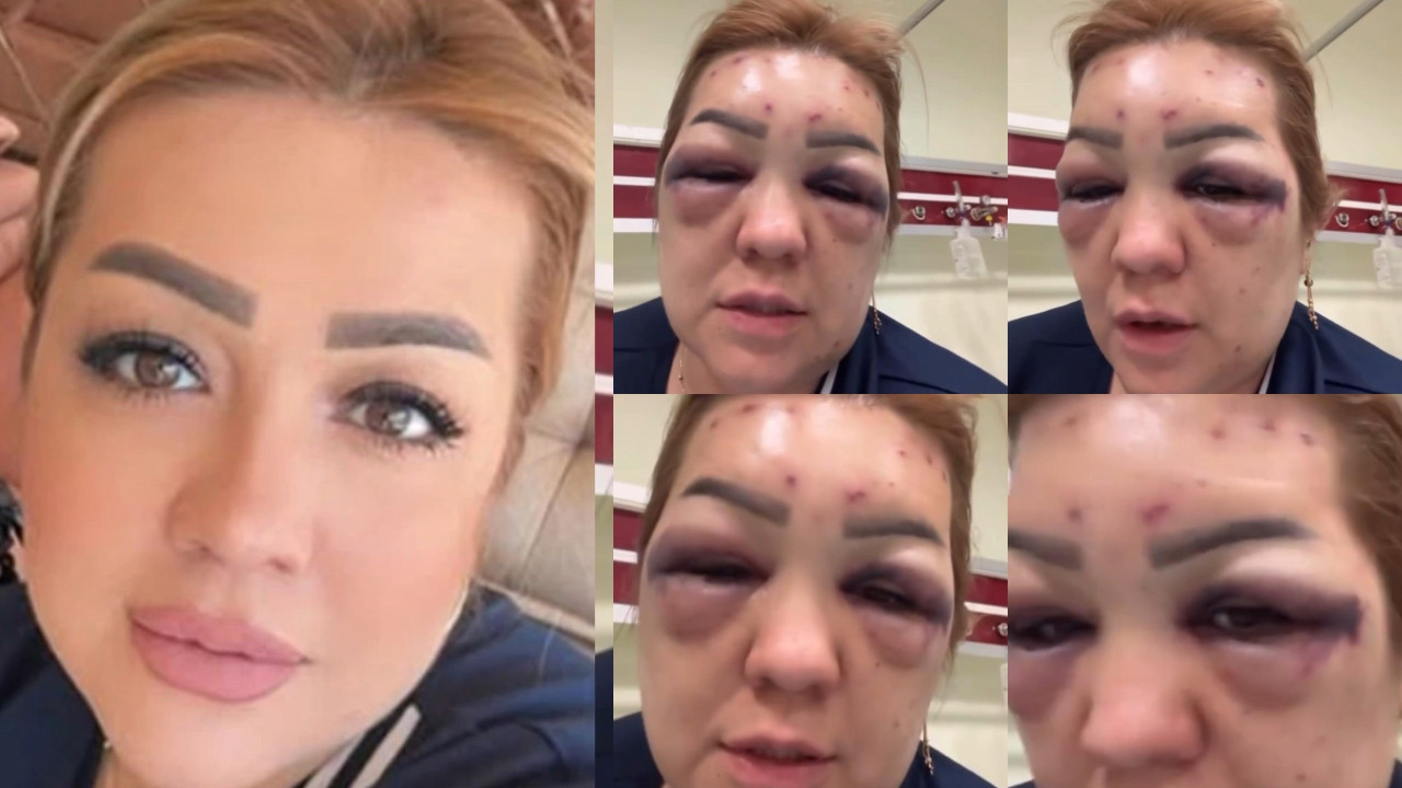 Güzellik uğruna tanınmayacak hale geldi