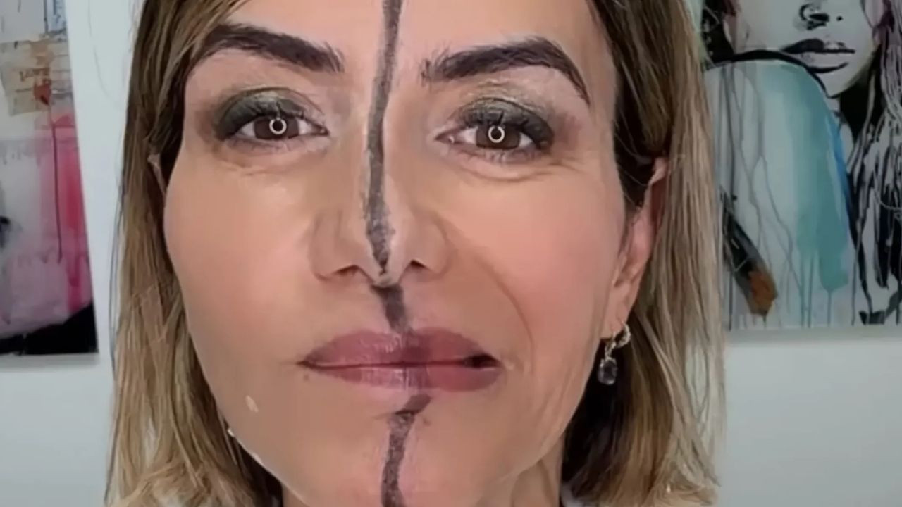 Yüzünün sadece bir tarafına botoks uyguladı, aradaki beklenmedik farkı gösterdi