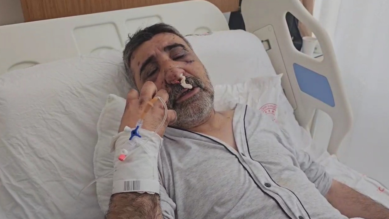 İngiliz boksörün dövdüğü taksici konuştu: Gözlerimi çıkarmaya çalıştı, ısırıp öptü