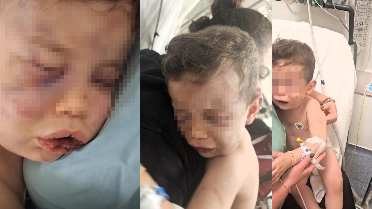 Vahşet! Annesinin sevgilisi bu hale getirdi