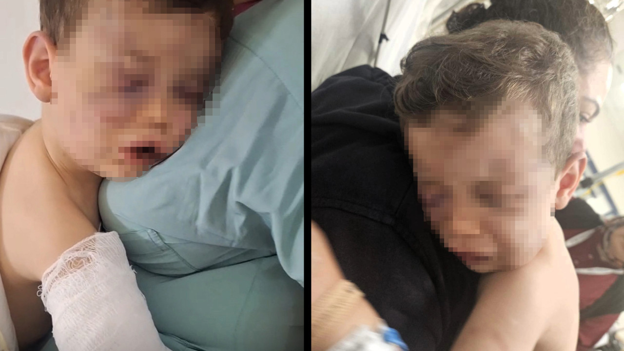 Devlet korumasına alınmıştı: Caniler gözaltında, Aren bebek ameliyat olacak