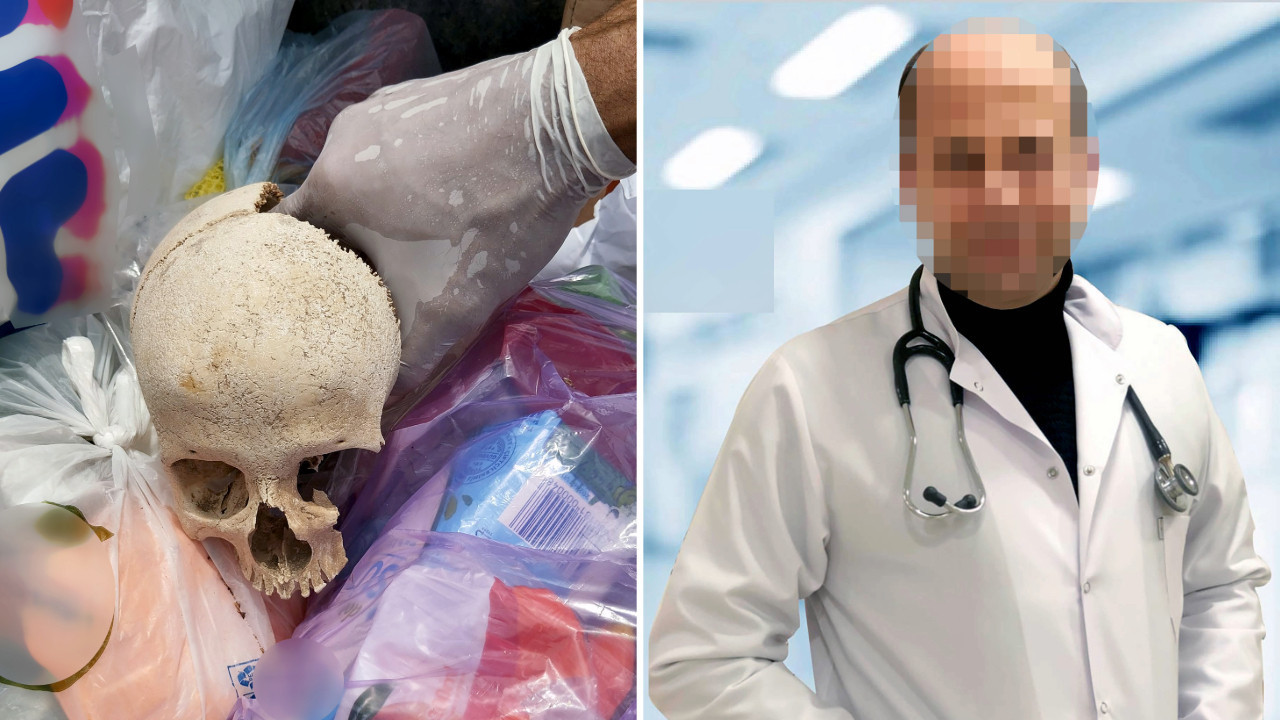 Çöpte bulunan kafatasını, uzman doktorun temizlik yapan eşi atmış
