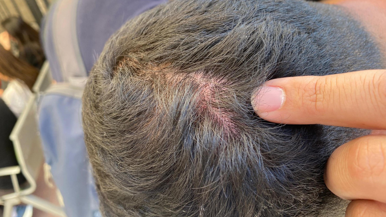 Sahne kurulumu sırasında vinç devrildi, çalışanlar gazetecileri darbetti