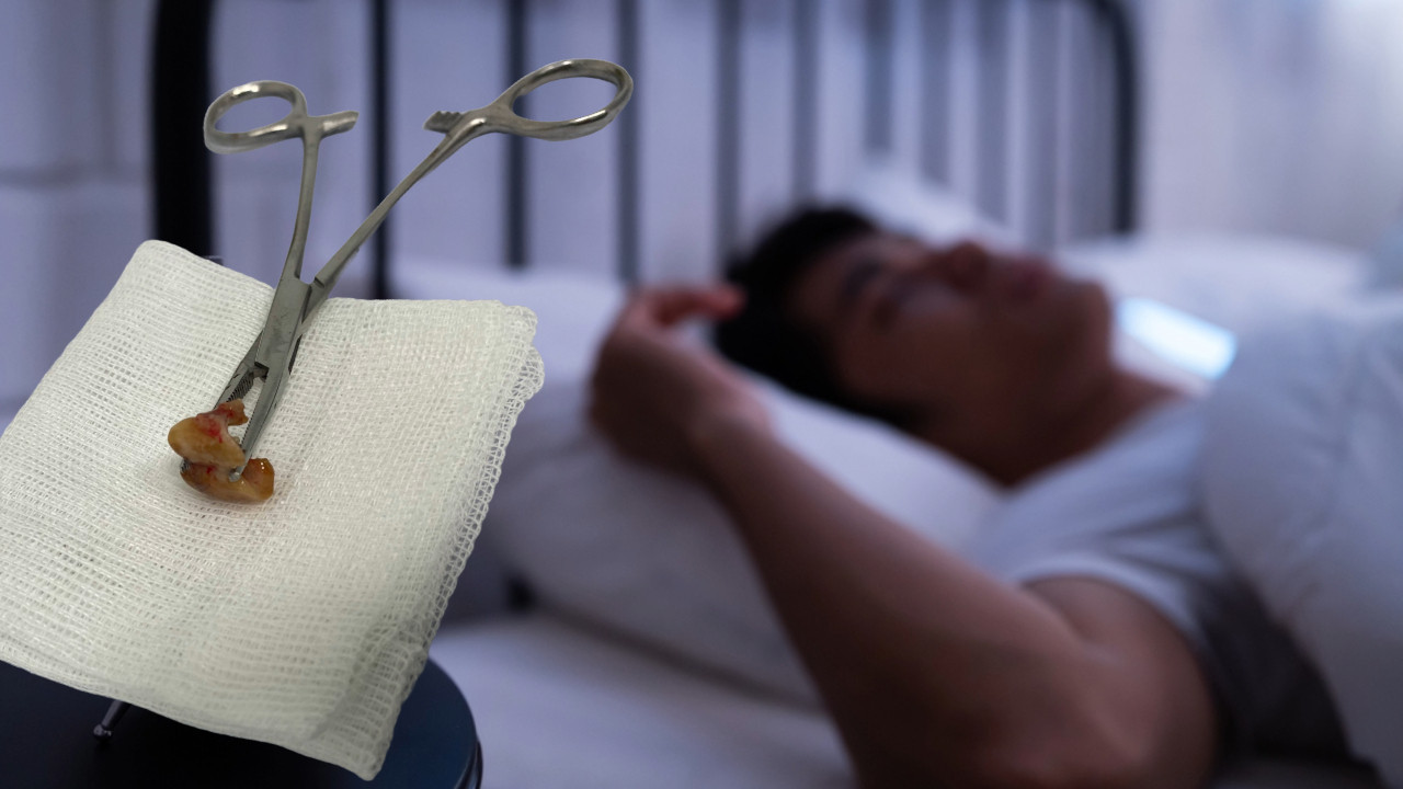 Öksürerek uyandı, sebebi şoke etti: Dişlerini yutmuş