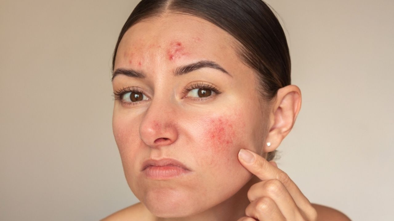 Dermatolog uyardı: Cildinizdeki bu izler kanserin habercisi olabilir