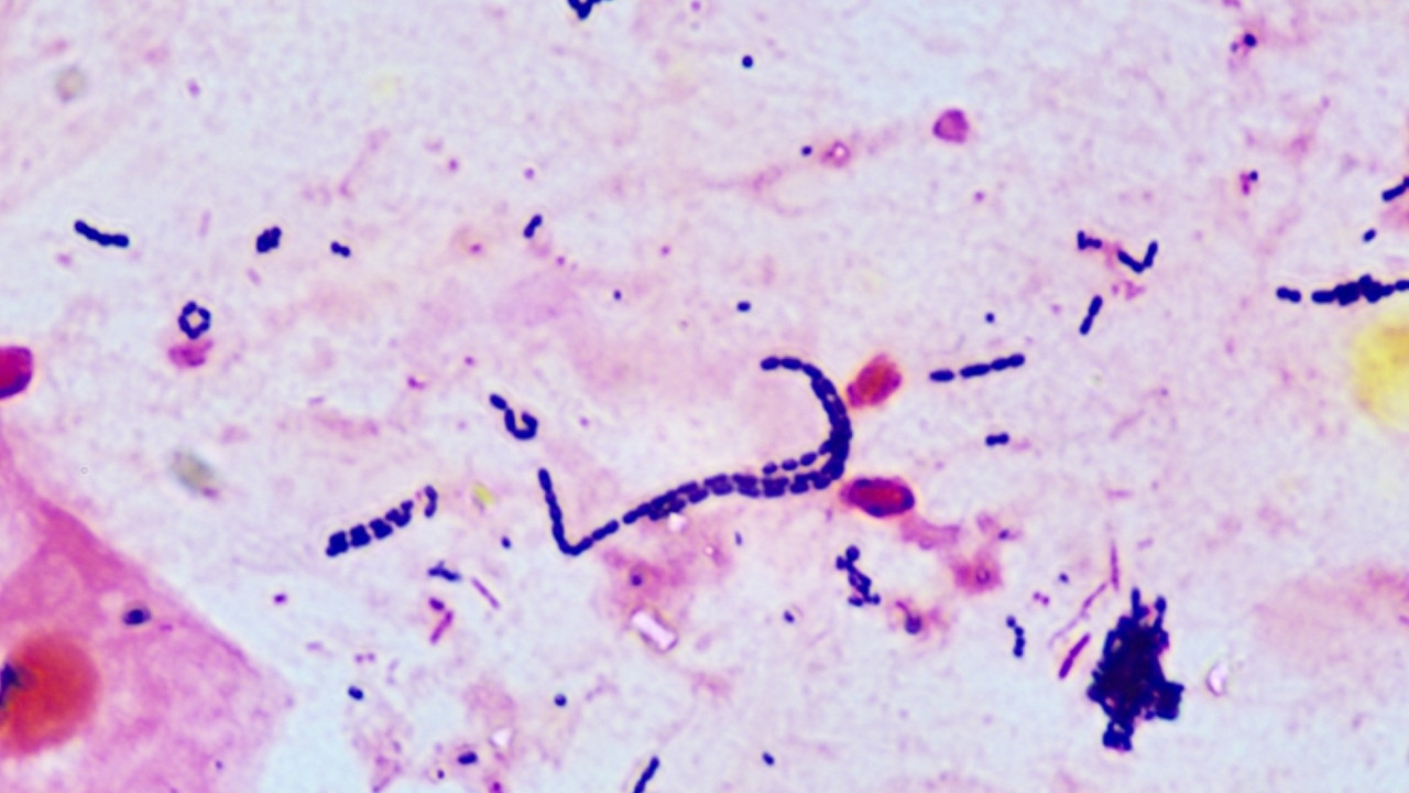 Komşuda bakteri paniği: Eğitime ara verildi