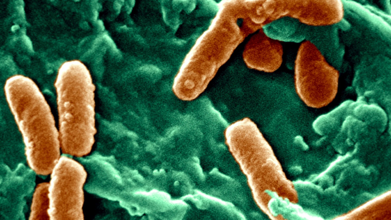 Tıbbi plastikle beslenen bakteri: Hastanelerde yılda 560 bin kişiyi öldürüyor