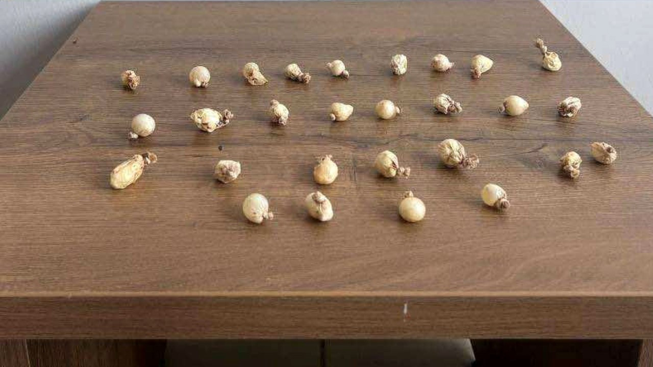 Midesinden 78 gram uyuşturucu çıktı