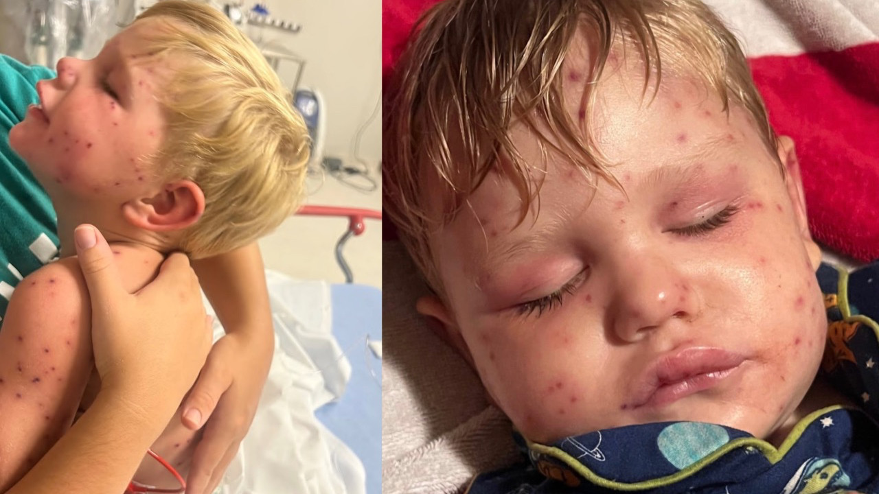 Korkunç olay: 2 yaşındaki çocuğa arılar saldırdı