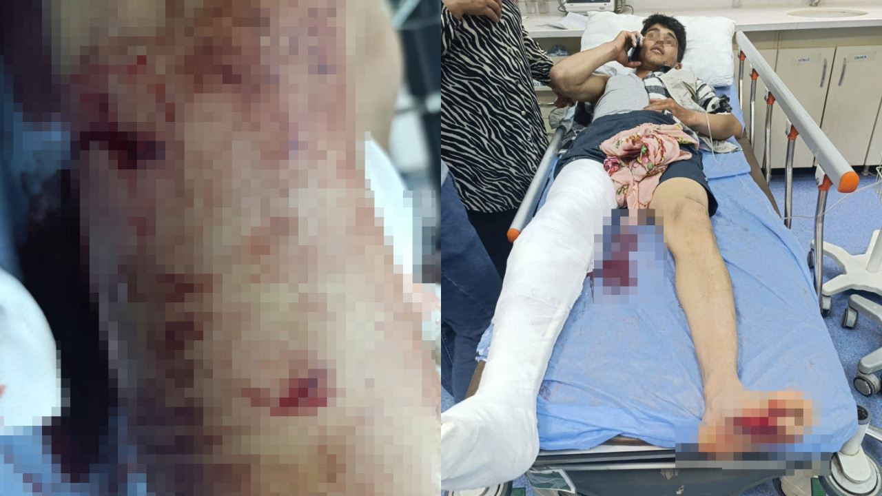 Kardeşinin çığlıkları ayının pençesinden kurtardı