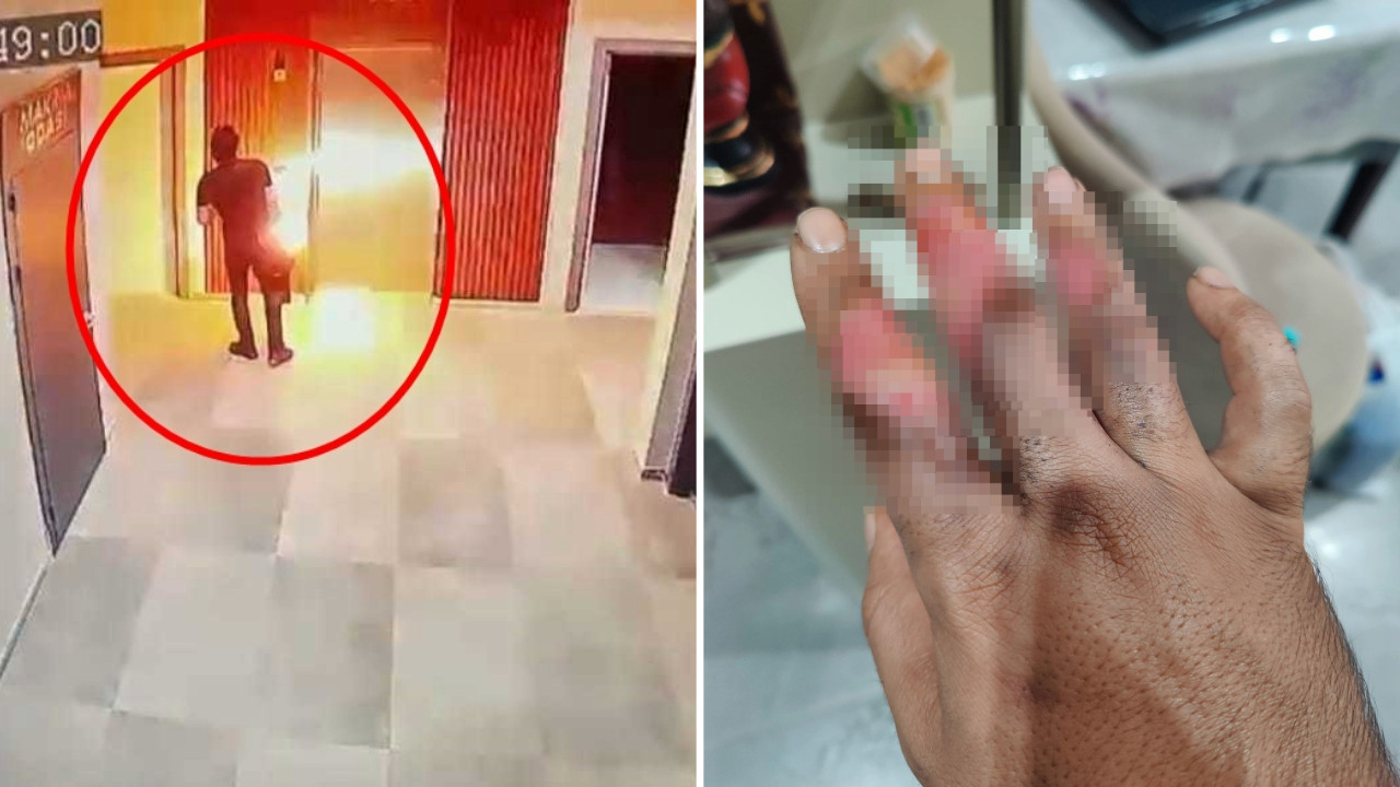 Elektrikli skuterin bataryası elinde patladı