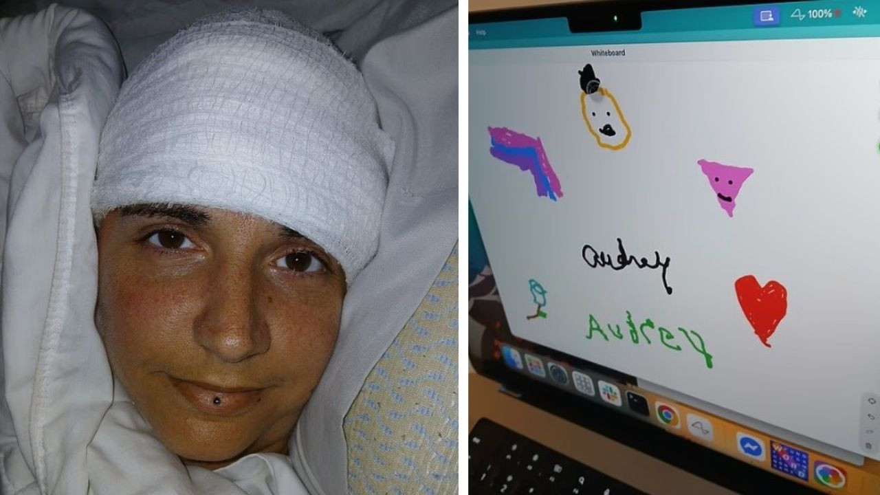 20 yıldır felçli kadın, beyin çipinin şoke edici etkisini gösterdi