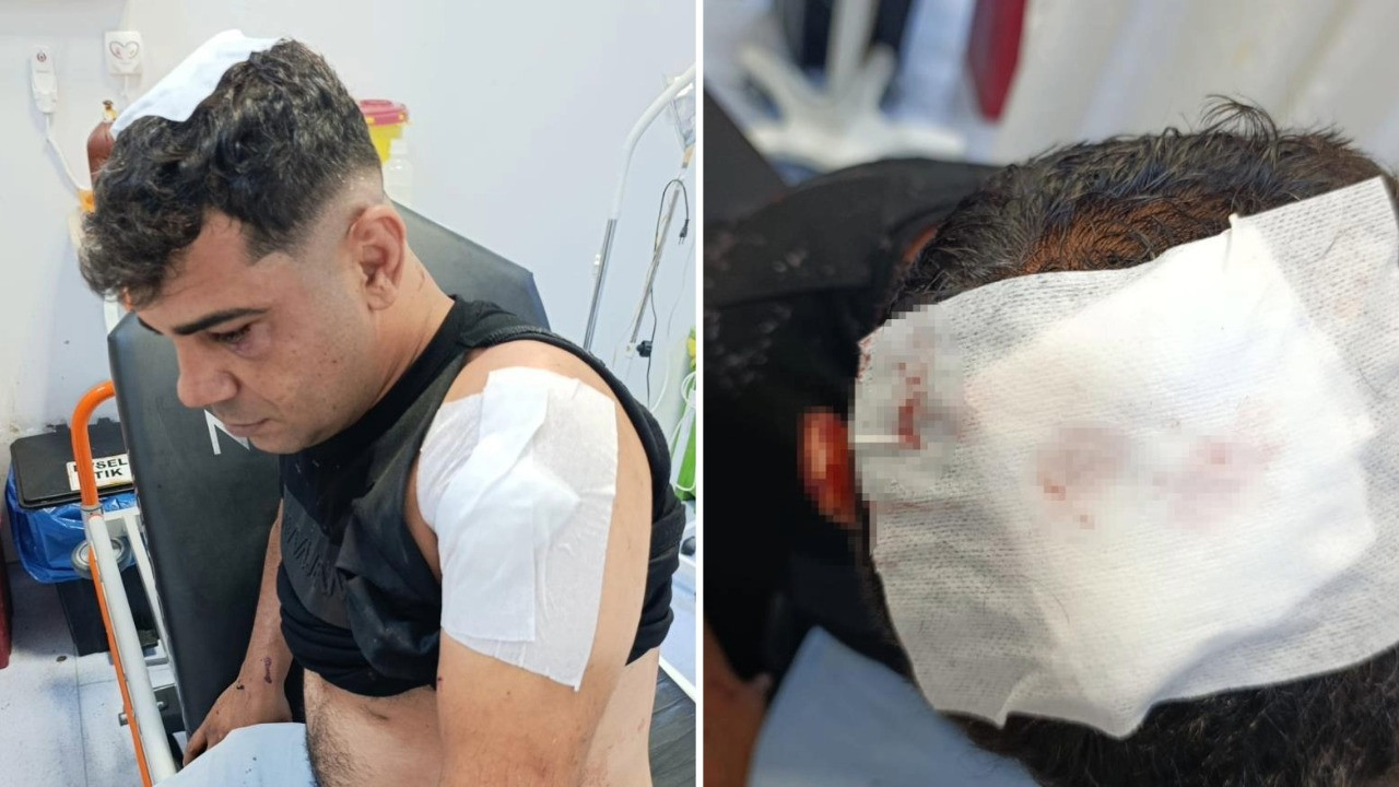 İş görüşmesine gitti, ölümden döndü
