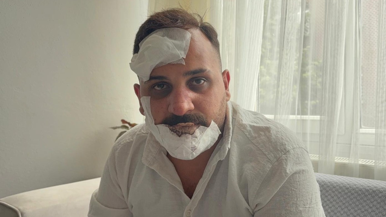 Taksici, eski sözlüsü ve ikizinin polis sevgililerinin kendisini dövdüğünü iddia etti