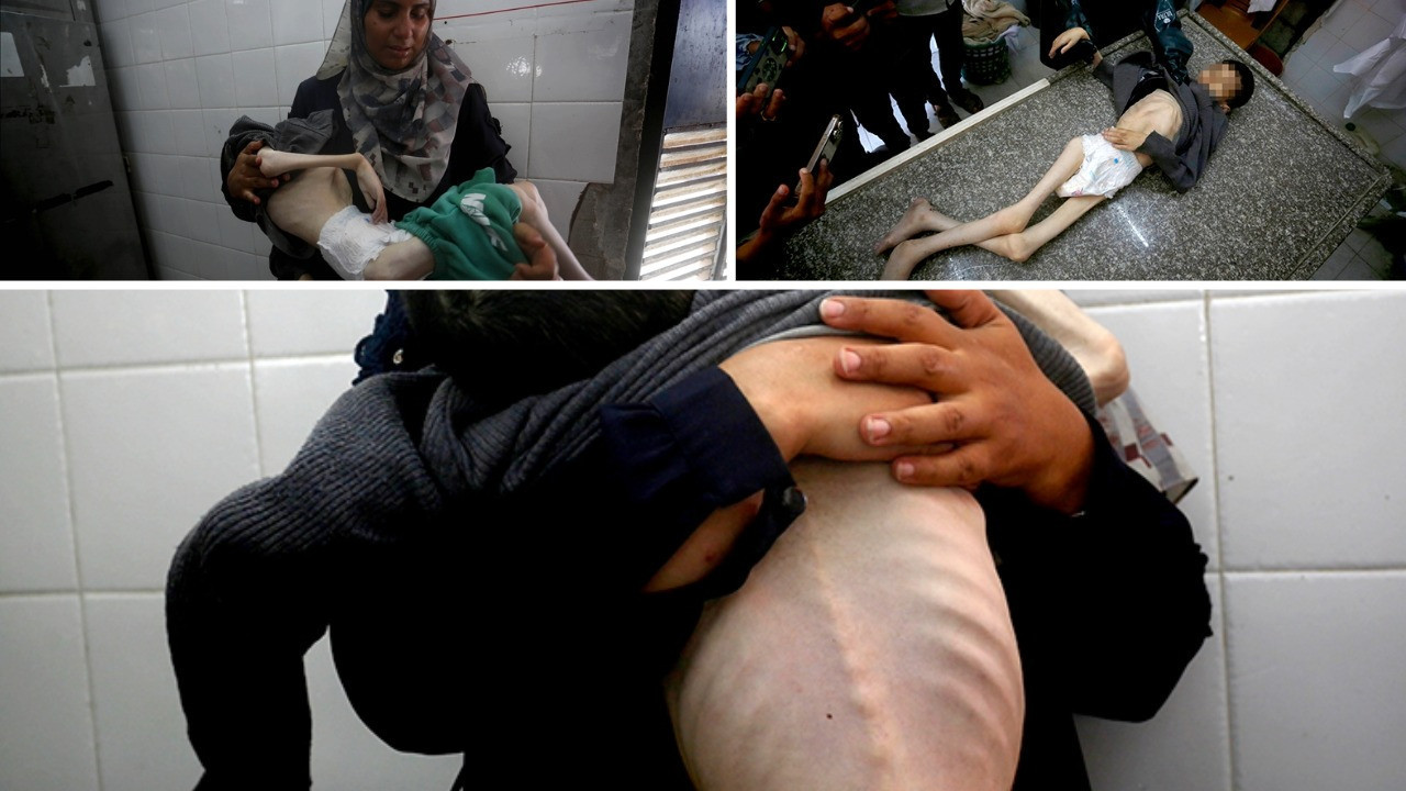 13 yaşındaki Tamir, annesinin kollarında açlıktan öldü