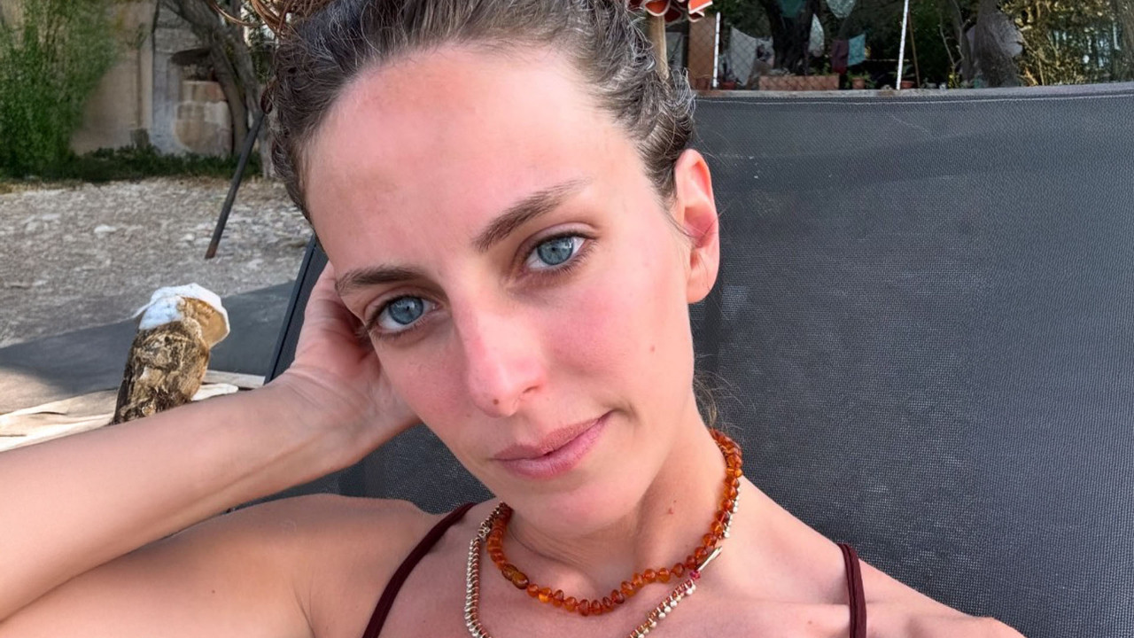 Bige Önal akrep sokması nedeniyle hastaneye kaldırıldı