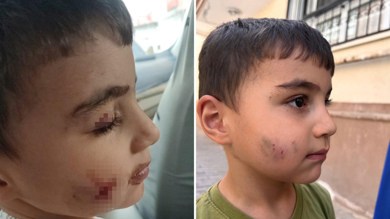 Evde uyuyan çocuğu lağım faresi ısırdı