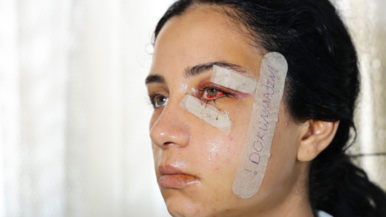 Öldüresiye dövüp serbest kaldı, kadının isyanı sonrası tutuklandı