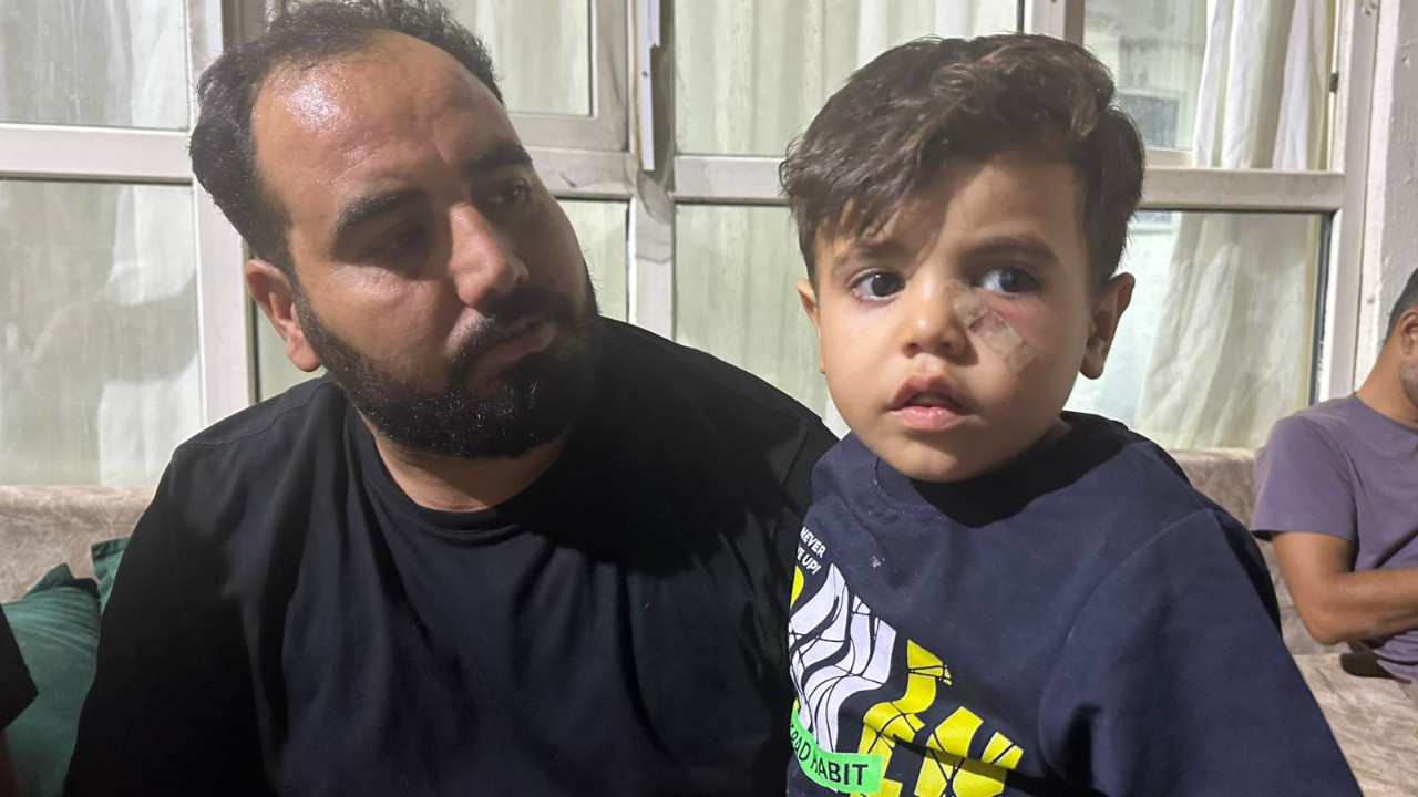 Yorgun mermi gözünün altına isabet etti