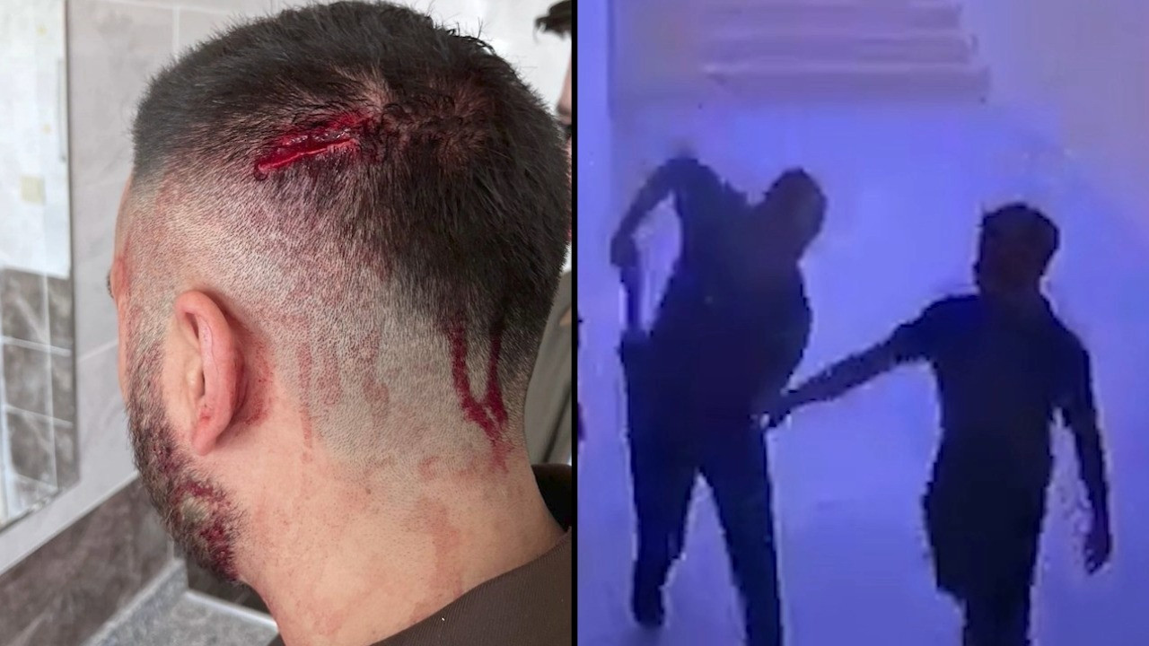 Öğretmene okulda demir sopalı saldırı: Görevi bıraktı