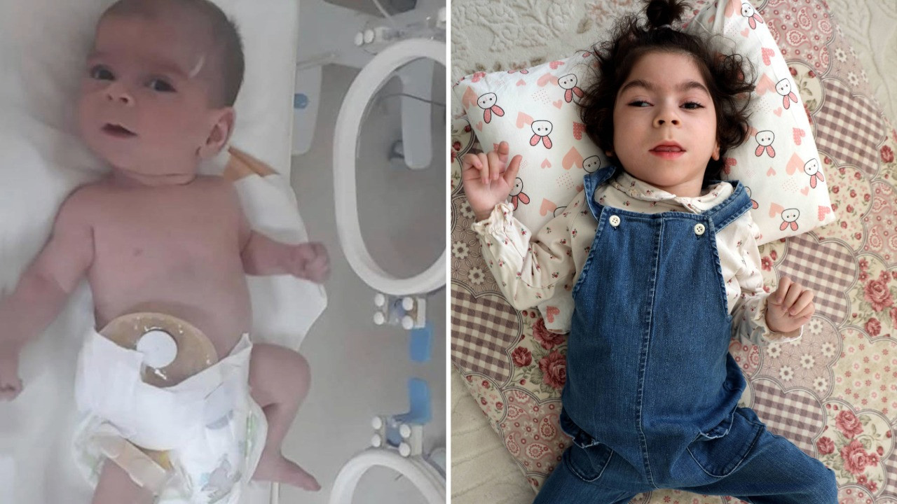 Bir yenidoğan skandalı daha! Kuvözde şiddet gördü, engelli kaldı