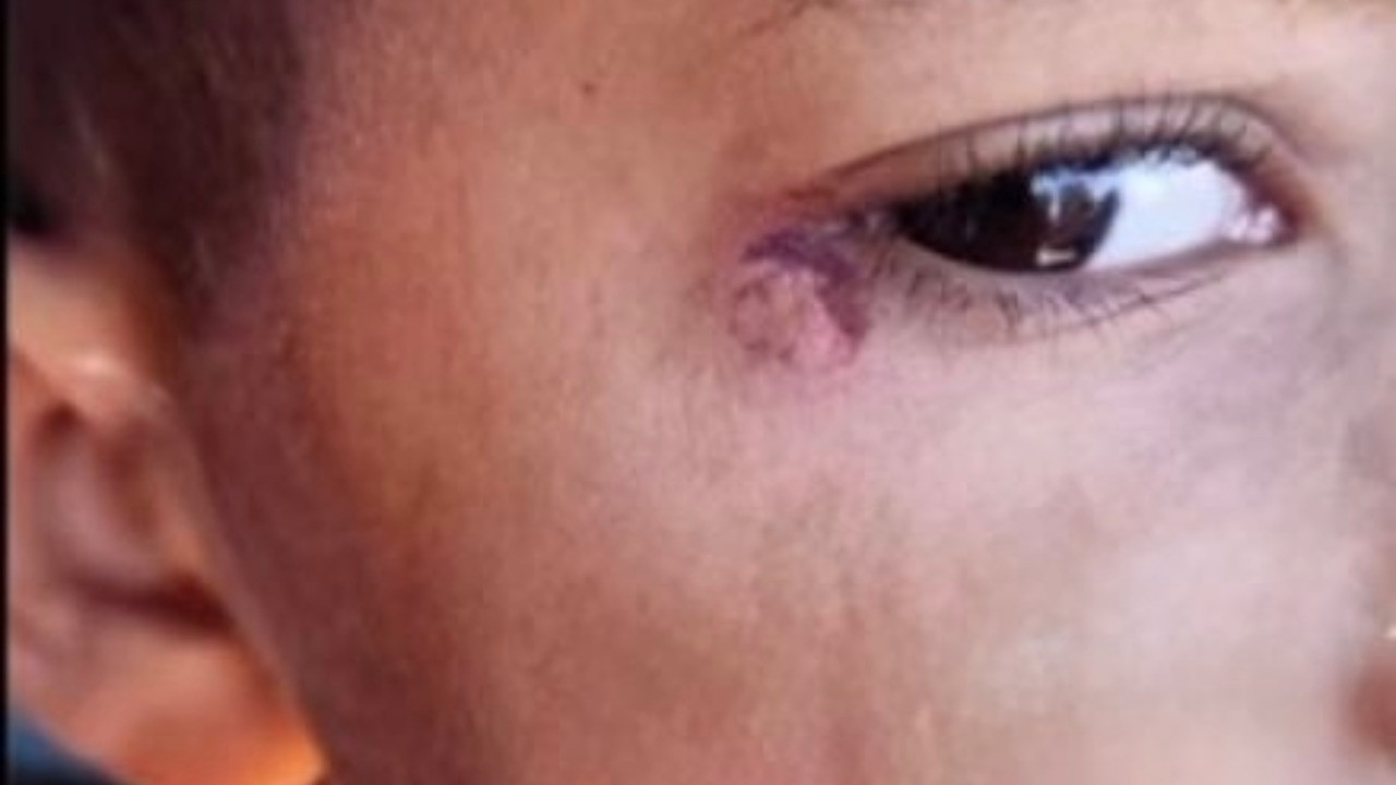 Vahşet: Öğrencinin yüzünde sigara söndürüldüğü iddiasına tutuklama