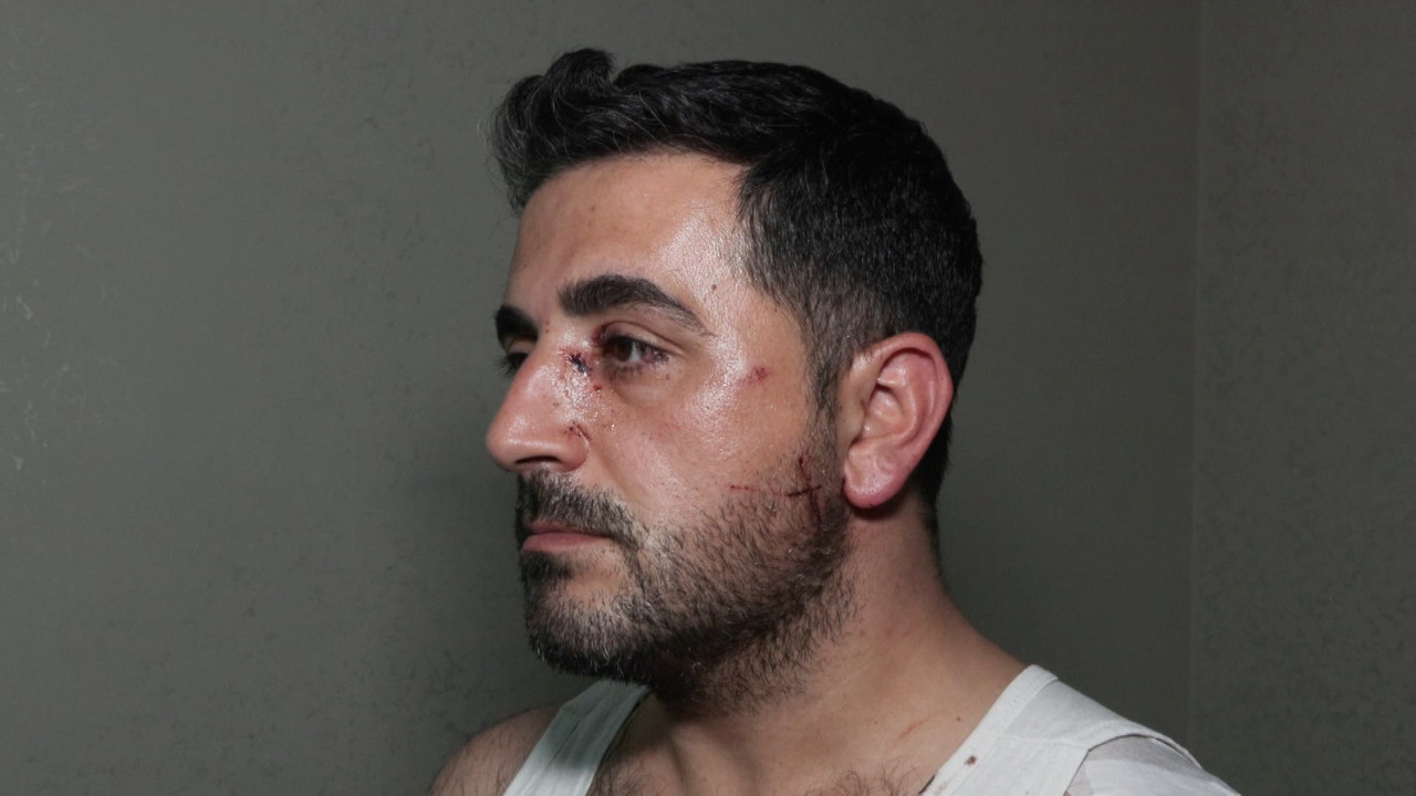 Eski kiracı ev sahibini bıçakladı