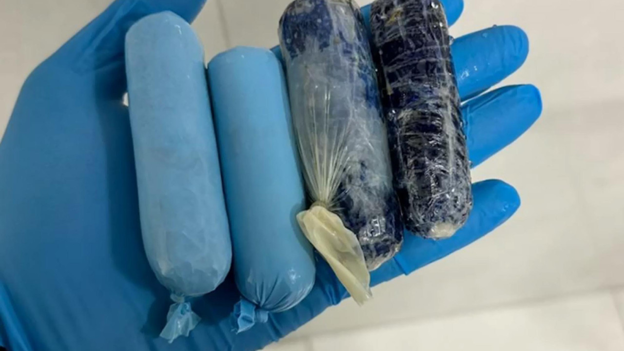 Sakladığı uyuşturucu muayenede ortaya çıktı