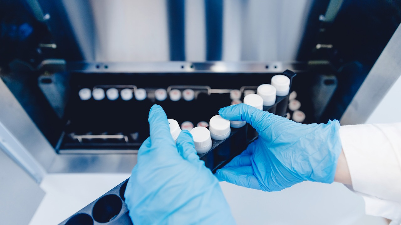 Sperm bankalarında yeni dönem: IQ testi yapılacak