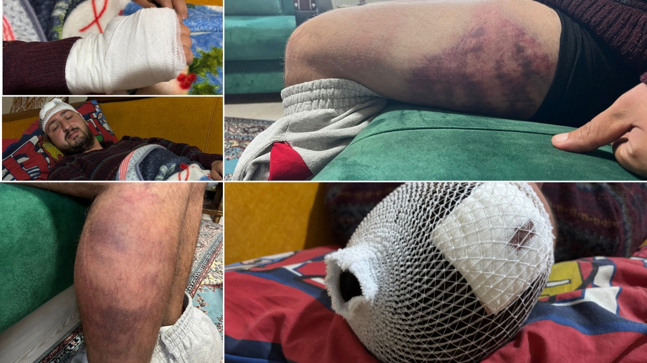 Odunluğa baktı diye odunla dövdüler