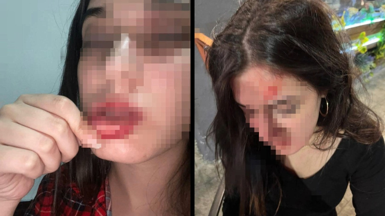 Sosyal medyada paylaştı: Darbedildim