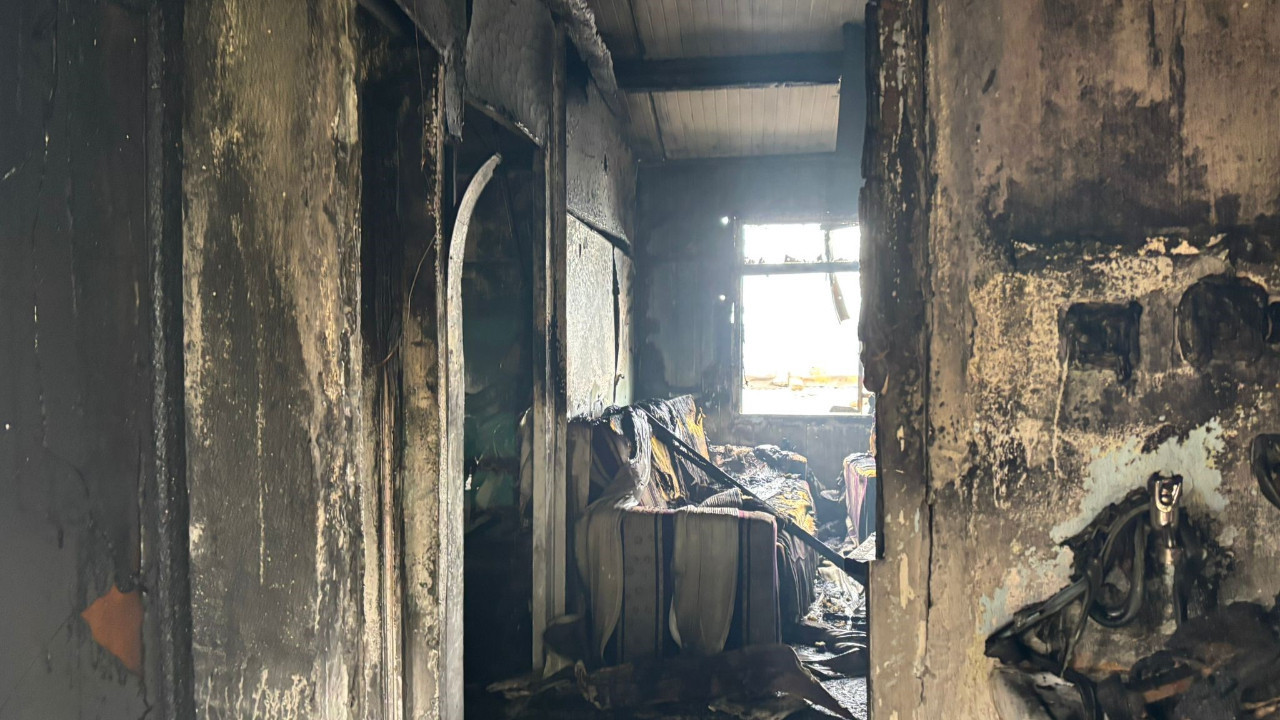 Bacakları ampute olduğu için yangından kaçamamıştı: Hayatını kaybetti