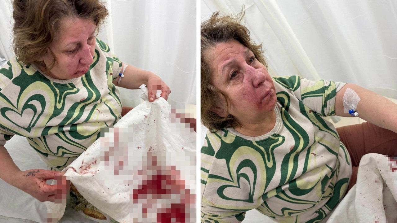 Komşusunu darp eden sivil memura soruşturma