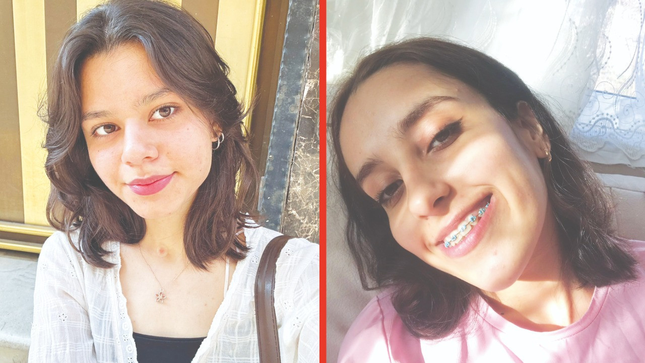 Diş yaptıramayan genç gülümsemeyi erteledi