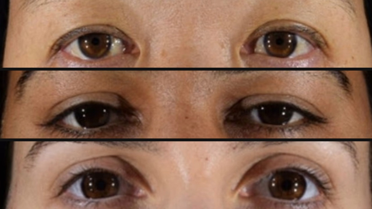 Hangisi genç, hangisi orta yaşlı? Göz çevresi yaşı ele veriyor