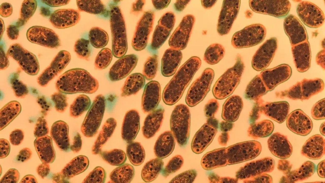 Ezber bozan araştırma: Sadece kadınları etkilemiyor