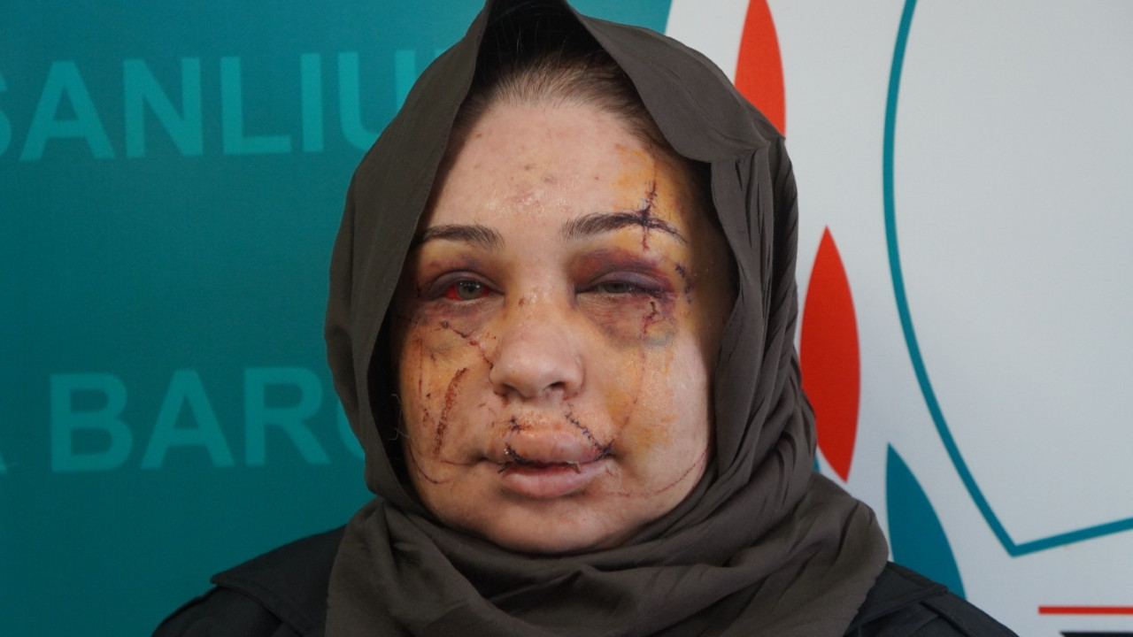 "Güzelliğini elinden alacağım" deyip yüzünü kesti: Serbest kaldı