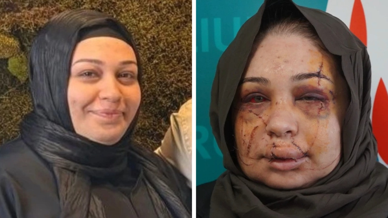 Boşanma aşamasındaki eşinin yüzünü kesen polis tutuklandı