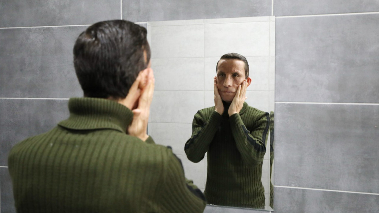 Türkiye’nin ilk yüz nâkiliyle, 14 yıldır hayata yeni bir yüzle bakıyor