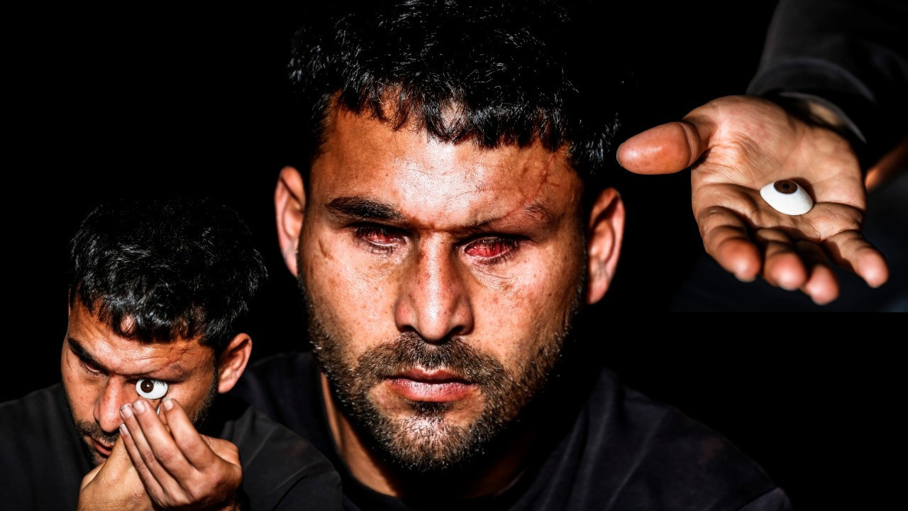 Savaşta iki kez yaralandı, gözlerini kaybetti