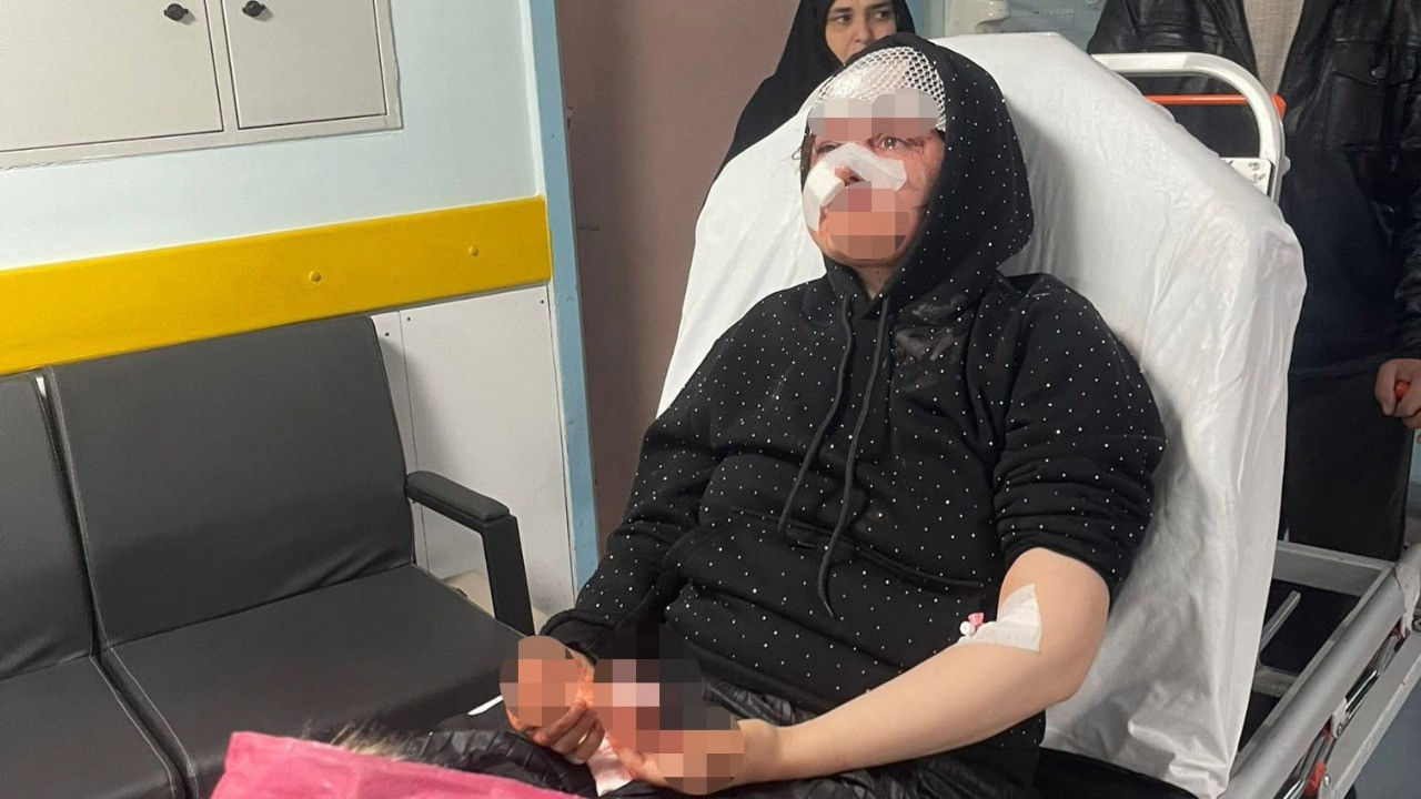 Boşanmak isteyen kadın öldüresiye darbedildi