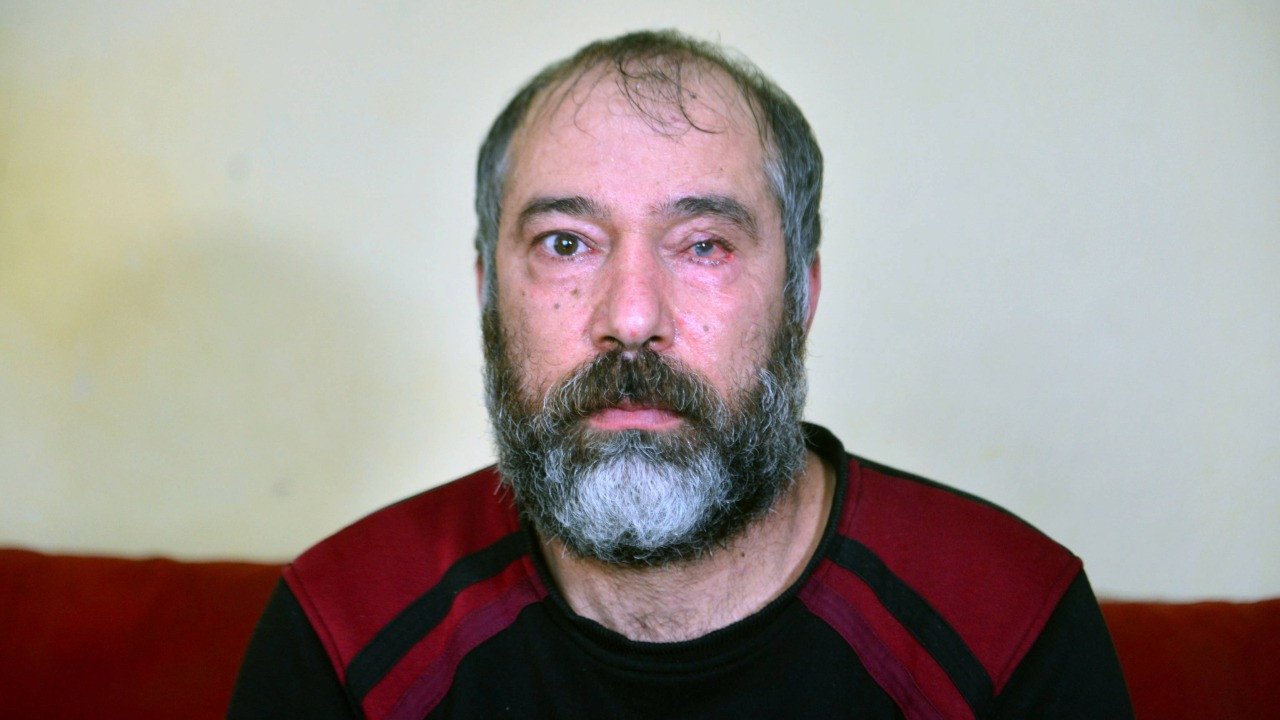 Çalışanın kör olmasına sebep olan yönetici serbest bırakıldı