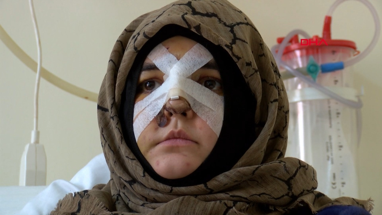 Kaldırım taşlı saldırıya uğramıştı: Çıkarsa beni öldürecek